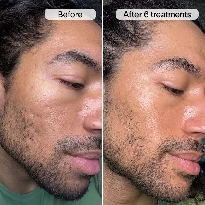 AARON-1 SQUARE.webp__PID:6e4392c9-89f4-4529-aeef-ca97b645a9e3