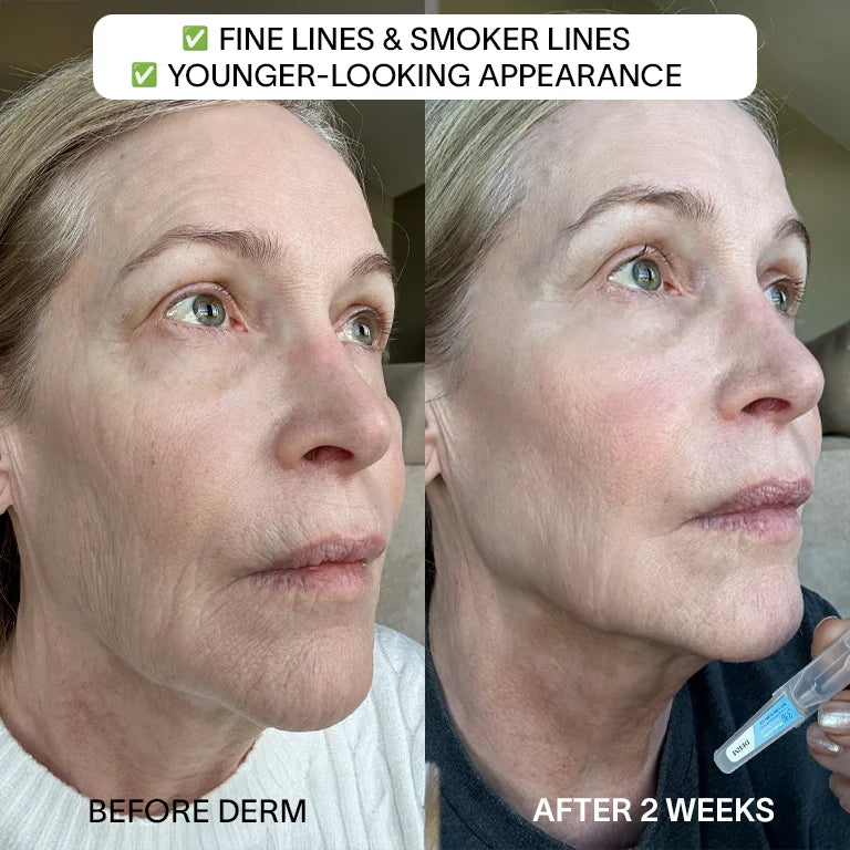 Derm™ 3% Hyaluronic Acid Serum