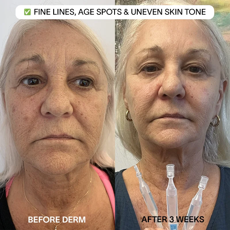 Derm™ 3% Hyaluronic Acid Serum