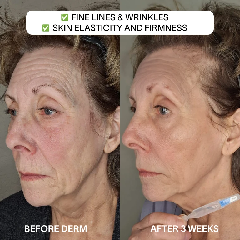 Derm™ 3% Hyaluronic Acid Serum