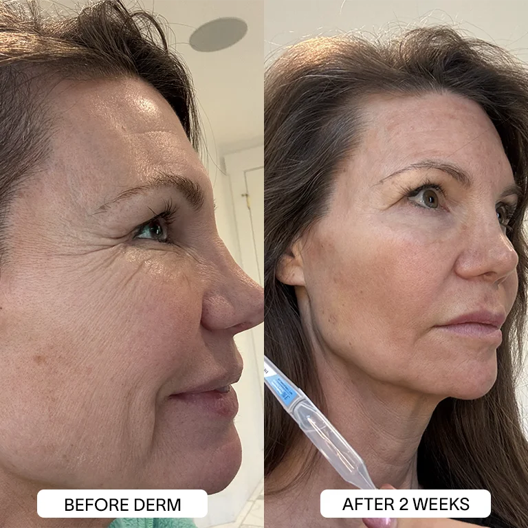 Derm™ 3% Hyaluronic Acid Serum