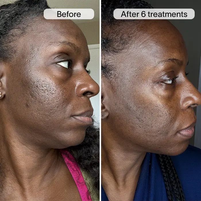 NICHOLE-1 SQUARE NEW.webp__PID:0d41f72c-b90b-4de0-bc03-894dd33dbfde