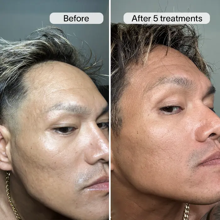 REIGN SQUARE NEW.webp__PID:4f6605cd-eb1b-4ca9-b5d1-49fb362c68fa