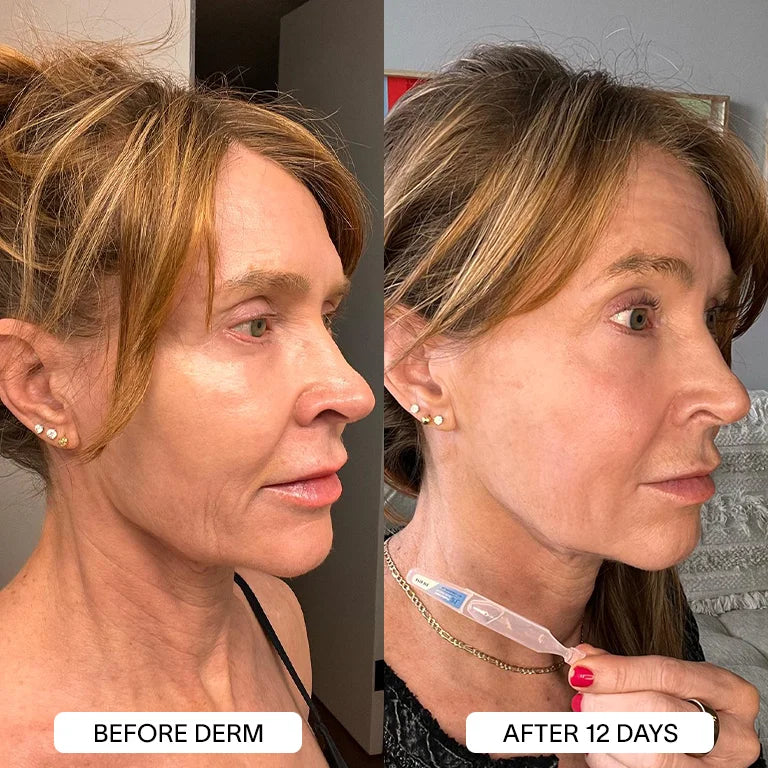 Derm™ 3% Hyaluronic Acid Serum