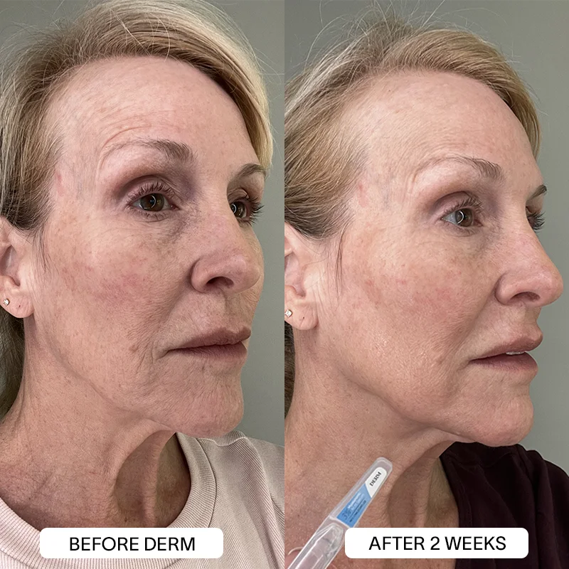 Derm™ 3% Hyaluronic Acid Serum